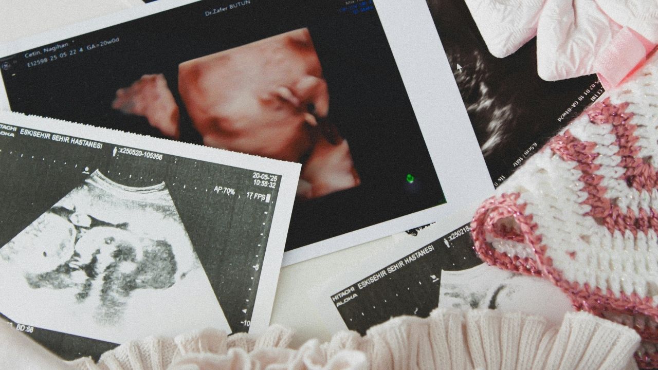 Pregnancy Ultrasounds